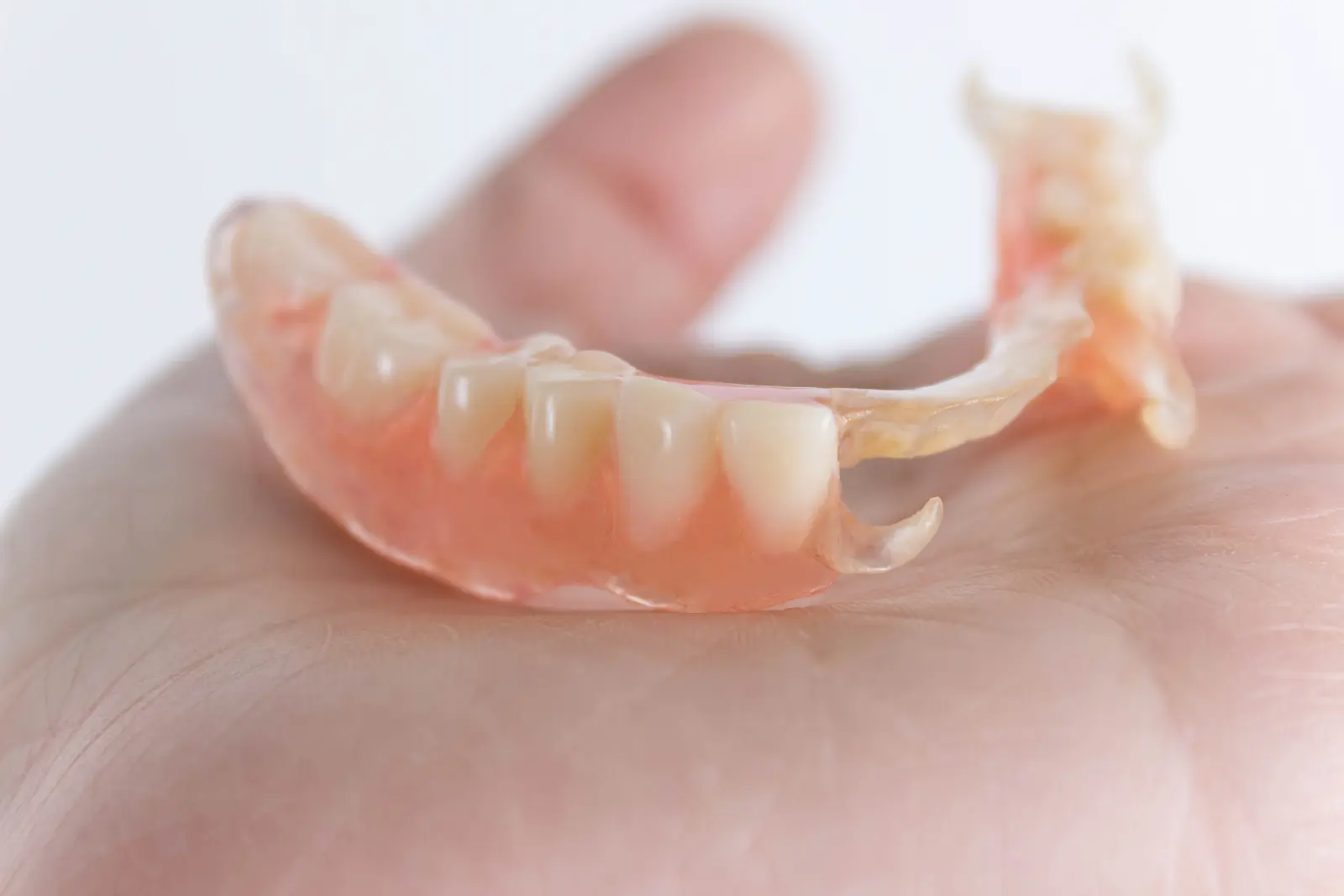 Prótesis dentales